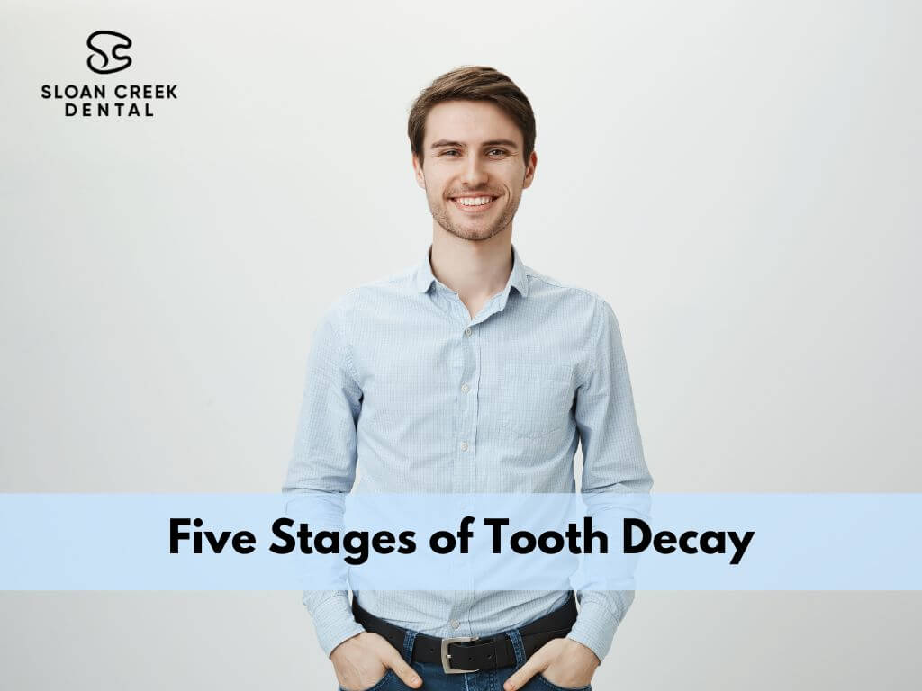5 stages of tooth decay