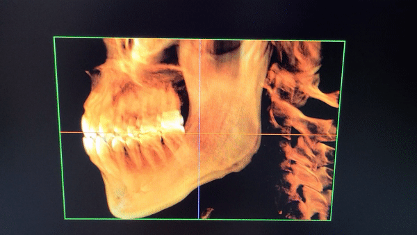 3d dental x ray image
