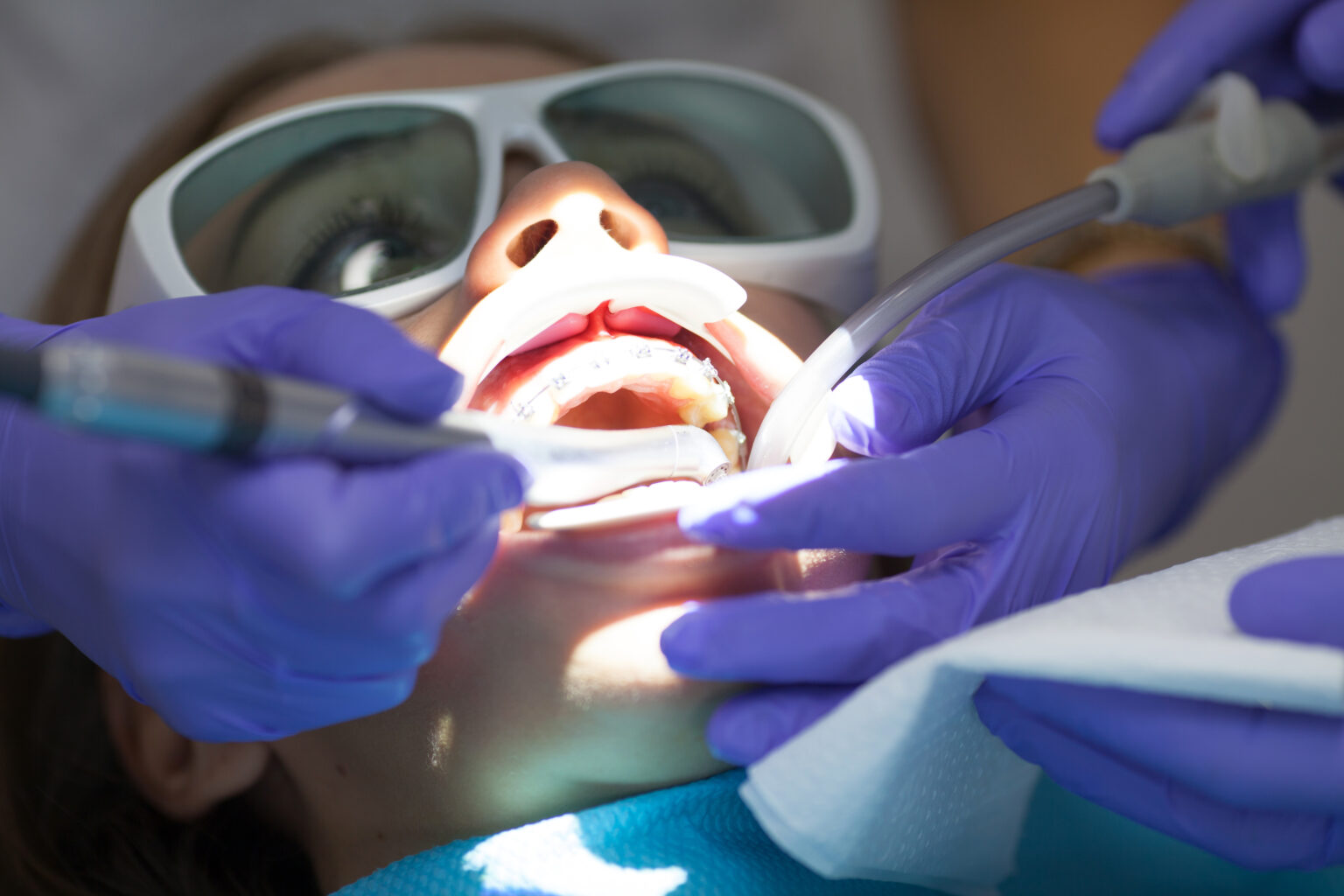 Photobiomodulation Therapy In Dentistry Sloan Creek Dental
