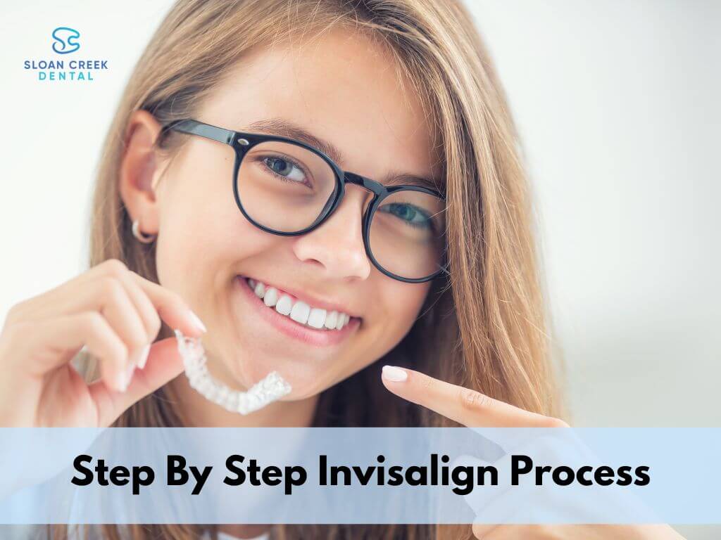 Step by step invisalign process